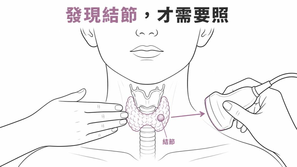 摸到腫塊或意外發現結節才需要做甲狀腺超音波的示意圖