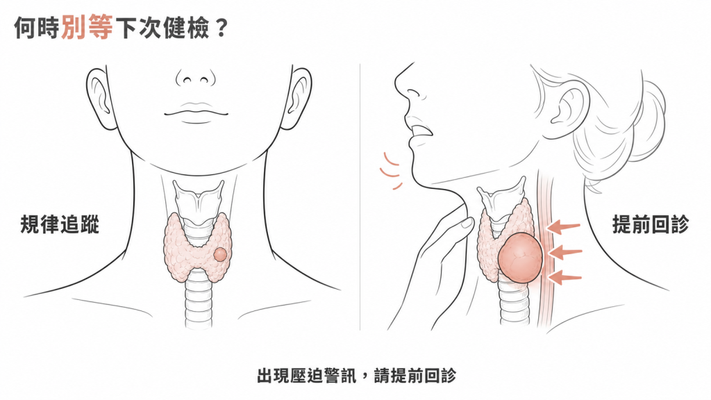 多數甲狀腺結節規律追蹤即可,出現腫塊快速變大或壓迫警訊時要提前回診