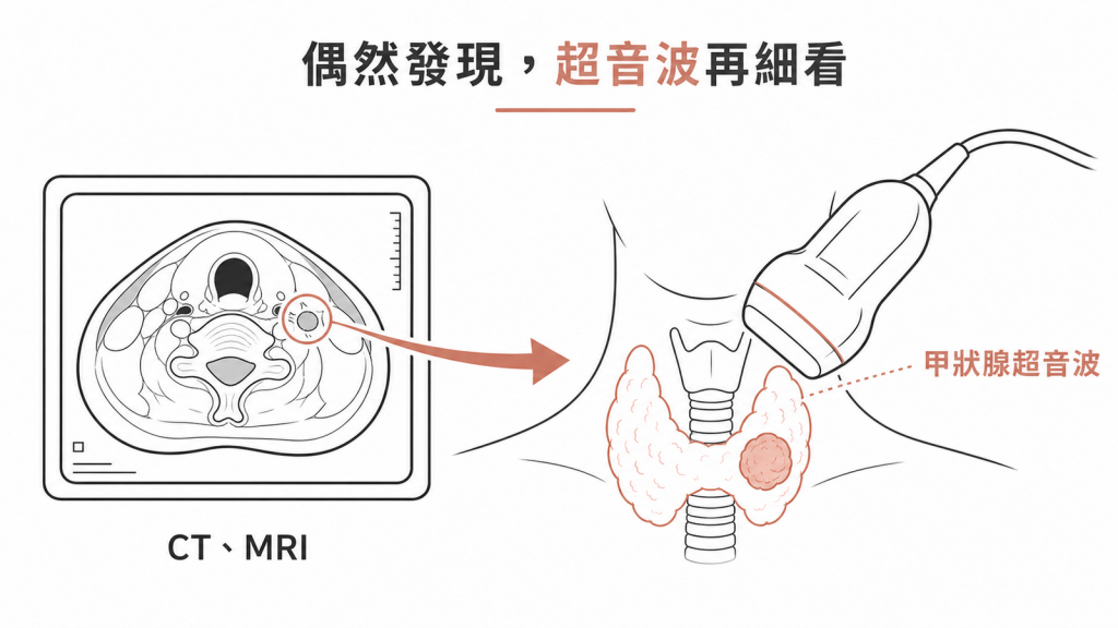 CT或MRI偶發甲狀腺結節再以專門超音波細看示意圖