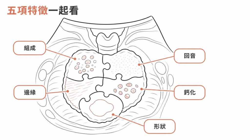 甲狀腺結節組成回音邊緣鈣化形狀五項特徵示意圖