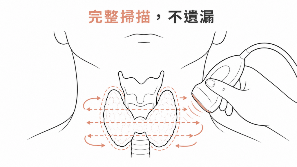 甲狀腺超音波完整掃描左右葉與峽部示意圖