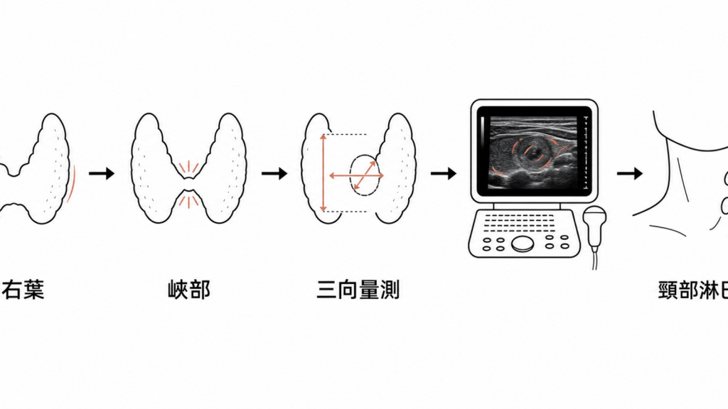 甲狀腺超音波固定順序與完整檢查流程