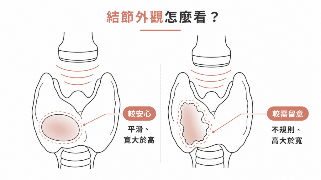 甲狀腺結節較安心與較需留意外觀對照圖