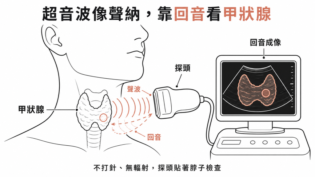 甲狀腺超音波像漁船聲納探頭發出聲波碰到甲狀腺組織反彈回音機器把回音畫成影像看有無結節不打針無輻射