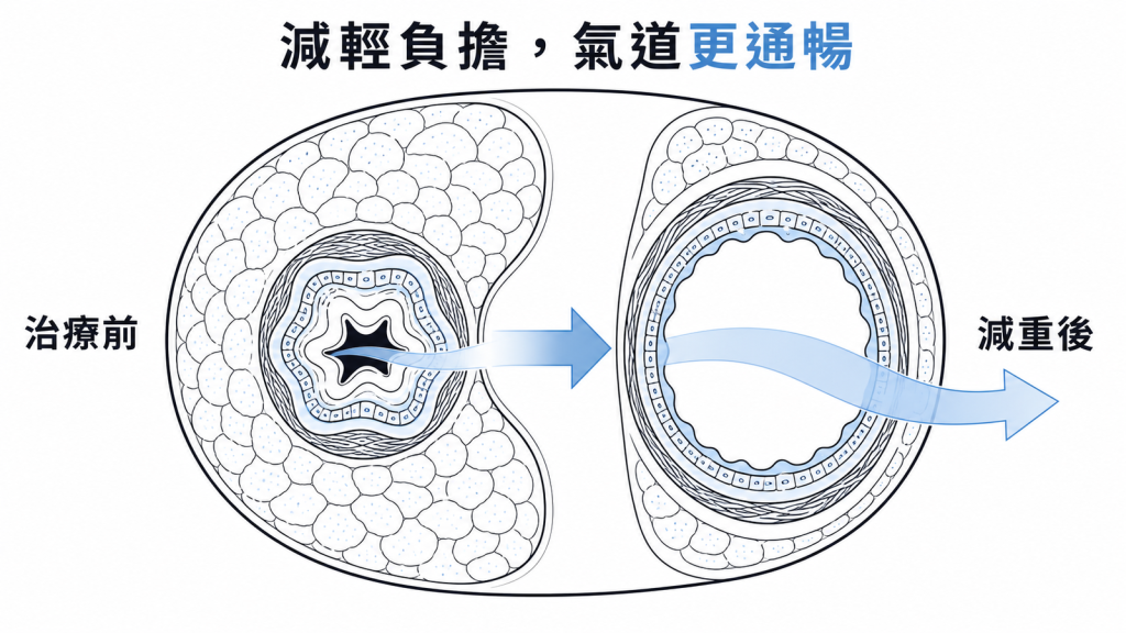 減輕脂肪負擔有助釋放呼吸道空間