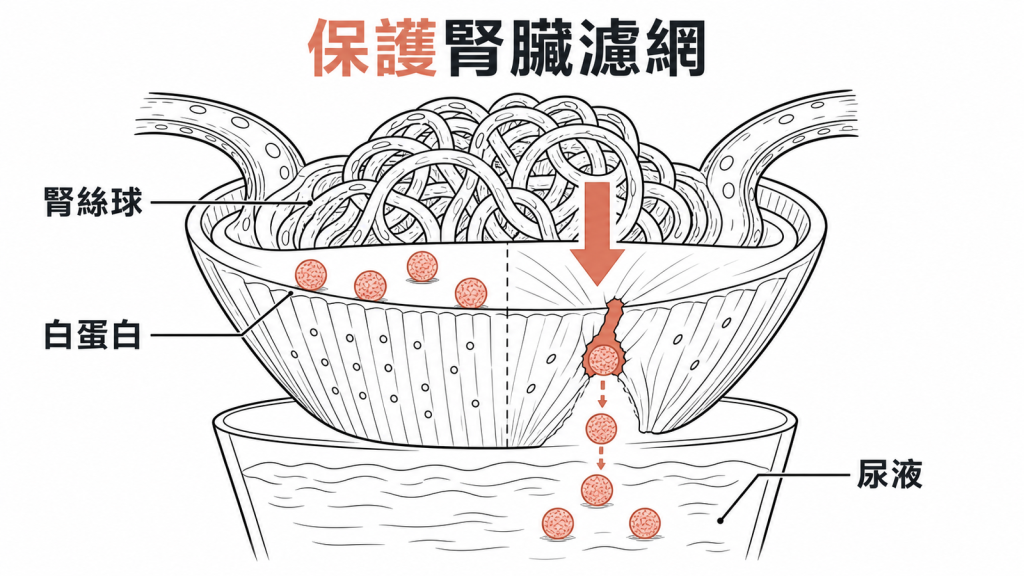 糖尿病會增加腎臟濾網壓力並造成白蛋白尿