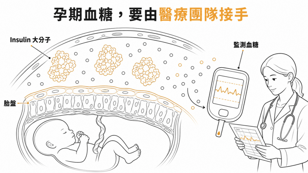 孕期血糖由醫療團隊以Insulin與監測接手示意圖