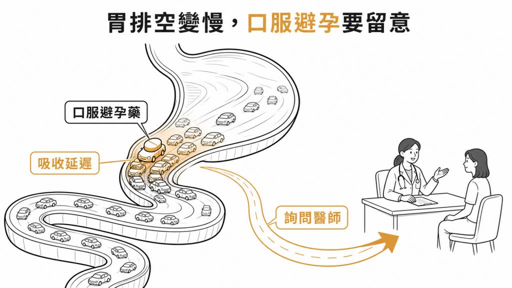 Tirzepatide延緩胃排空可能影響口服避孕藥吸收示意圖