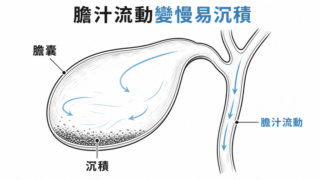 膽囊收縮減少會讓膽汁流動變慢