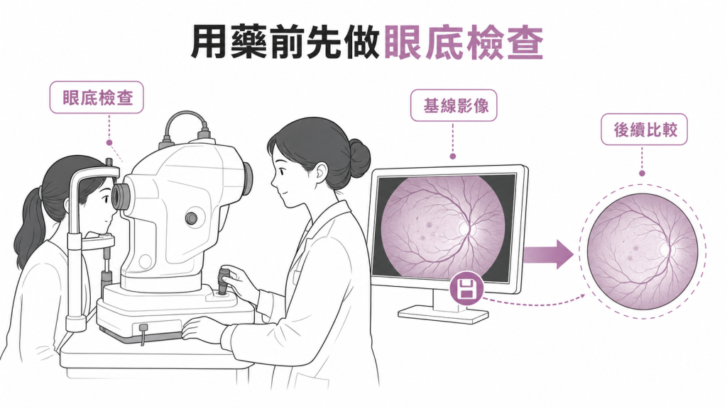 開始用藥前先建立眼底基線