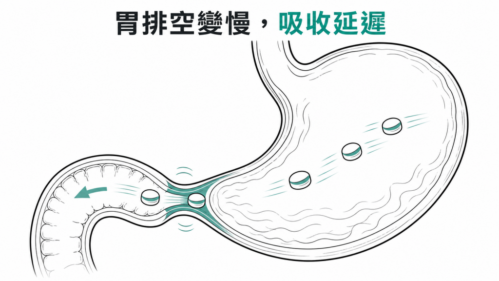 胃排空變慢影響口服避孕藥吸收