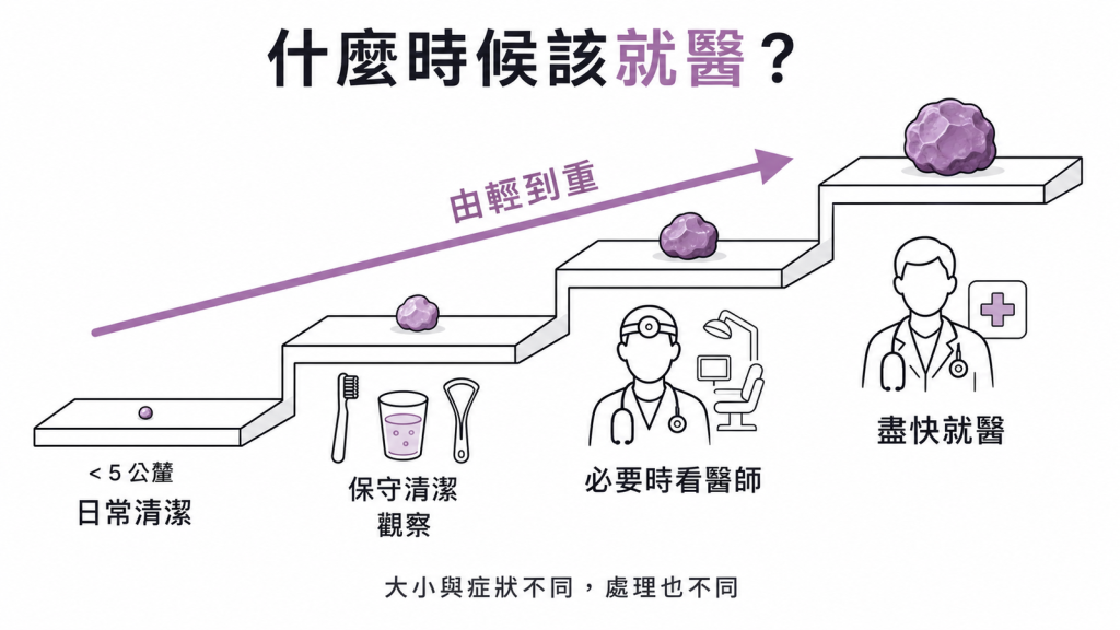 扁桃腺結石依大小與症狀分級：小於5公釐日常清潔即可，大結石影響吞嚥需盡快就醫