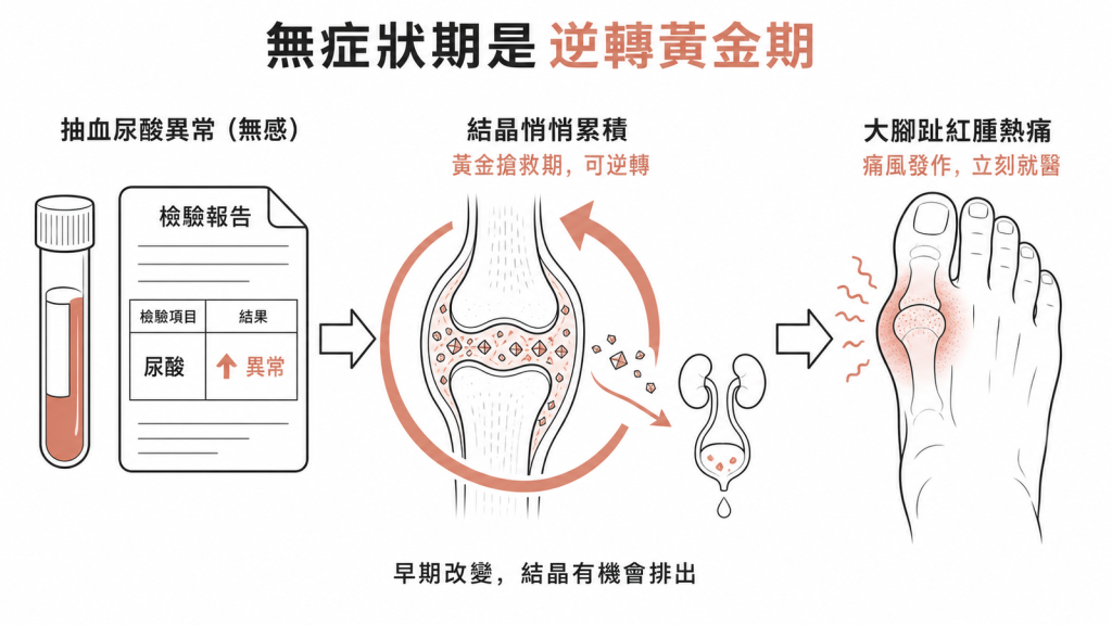 無症狀高尿酸血症是逆轉黃金期及早改變生活習慣結晶有機會排出否則進展為大腳趾紅腫熱痛的痛風