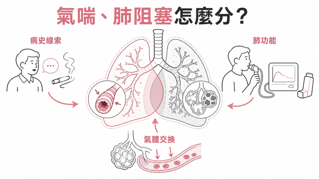 氣喘與肺阻塞重疊(ACO)判讀重點:病史線索、肺功能與氣體交換能力