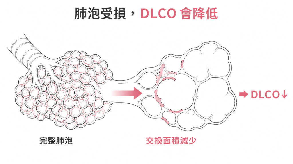 肺泡受損讓氣體交換面積減少,DLCO 隨之下降