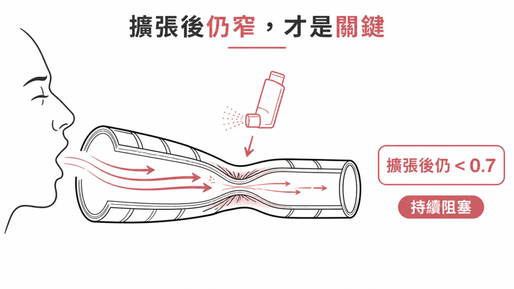 支氣管擴張劑後仍然變窄,代表阻塞持續存在