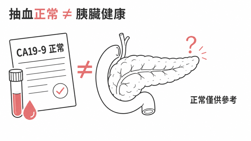 CA19-9 指數正常不等於胰臟健康,敏感度不足只能當參考