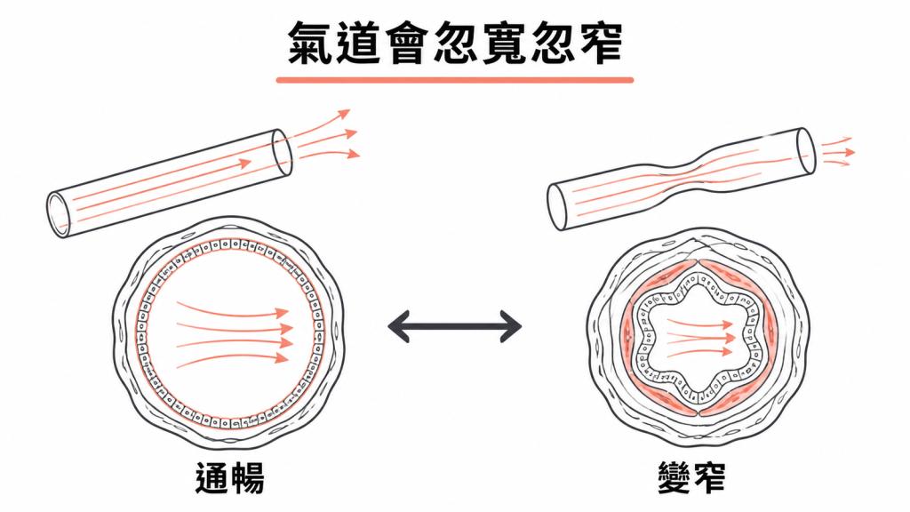 氣喘氣道可在通暢與變窄之間變化示意圖