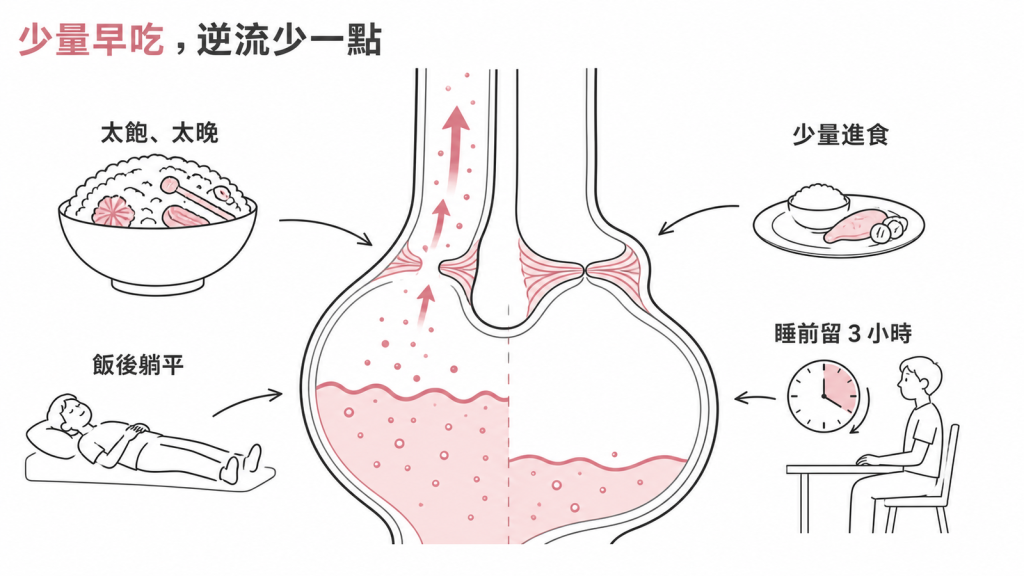 吃太飽太晚與飯後躺平會誘發胃酸逆流、少量進食與睡前留三小時可減少逆流的對照示意圖