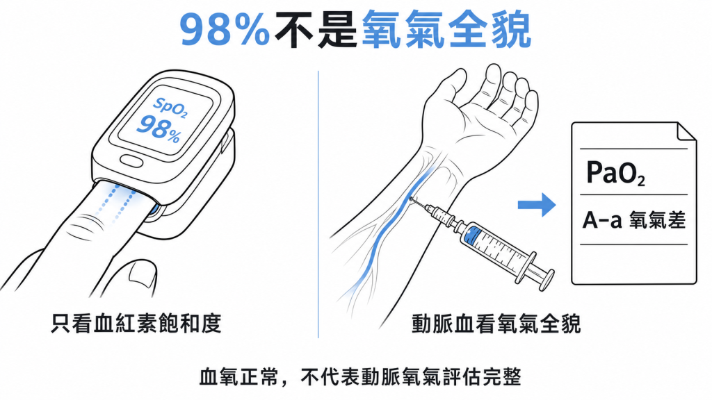 常見誤解澄清示意圖：指夾式血氧機只測血紅素飽和度，無法取代動脈血提供的含氧與 A-a gradient 資訊