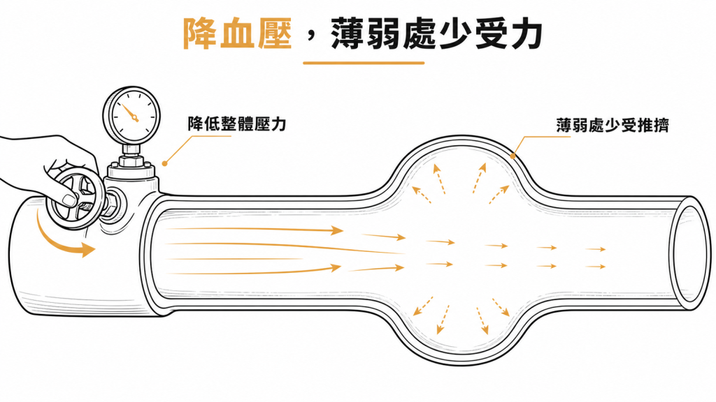 降低血壓可讓腦動脈瘤薄弱的血管壁少受推擠