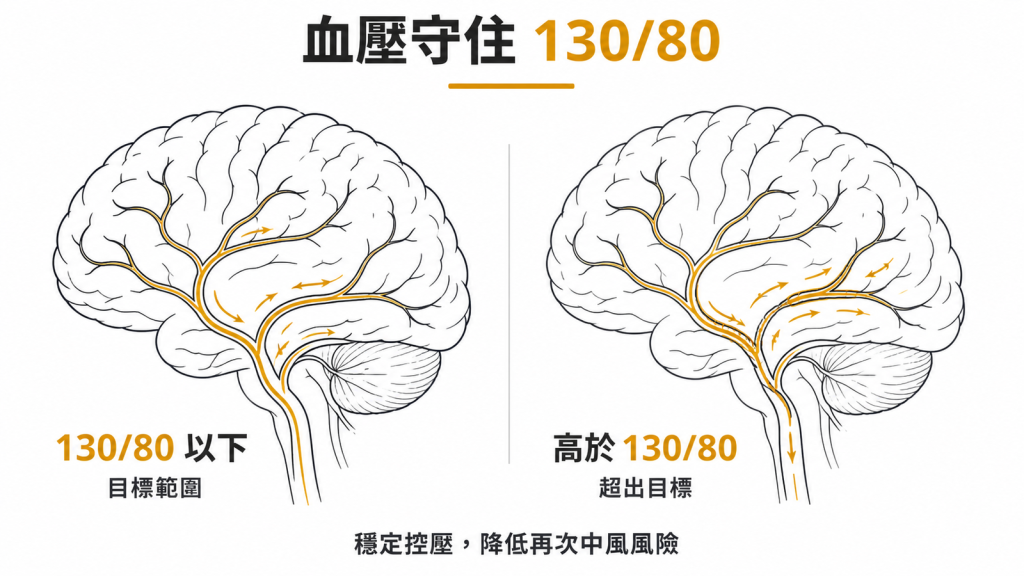 腦動脈瘤的血壓目標是 130/80 mmHg 以下,穩定控壓可降低再次中風風險