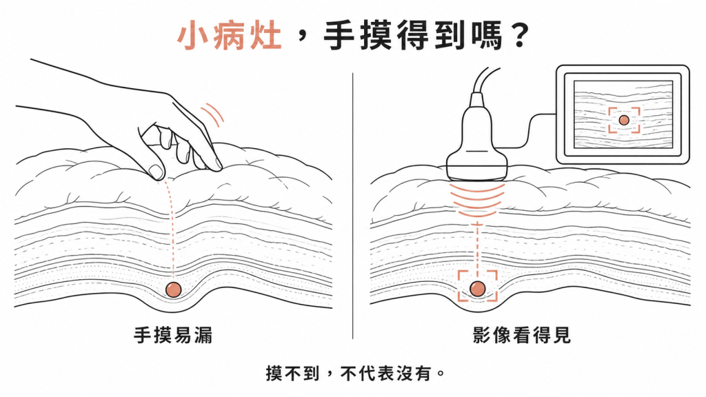 小病灶用手觸診容易漏掉，影像檢查才看得見