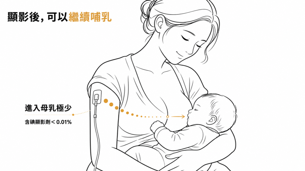 含碘顯影劑分泌到母乳的比例不到百分之零點零一,檢查後可繼續哺乳