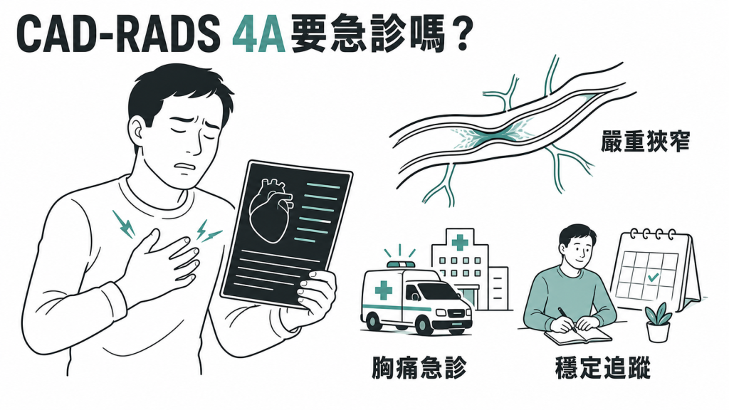 CAD-RADS 4A冠狀動脈嚴重狹窄與胸痛就醫判斷圖