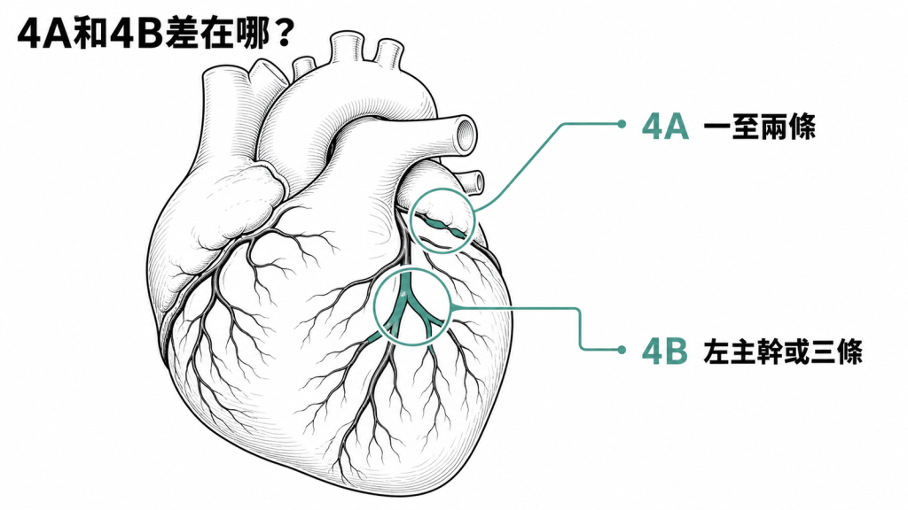 CAD-RADS 4A與4B血管範圍比較圖