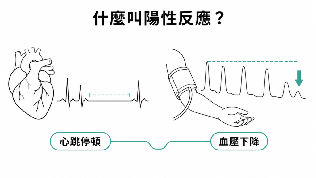 頸動脈竇按摩陽性反應包含心跳停頓與血壓下降示意圖