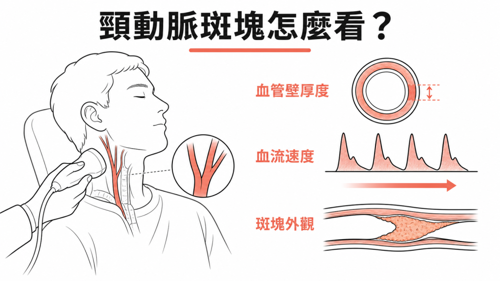 頸動脈超音波判讀血管壁厚度、血流速度與斑塊外觀