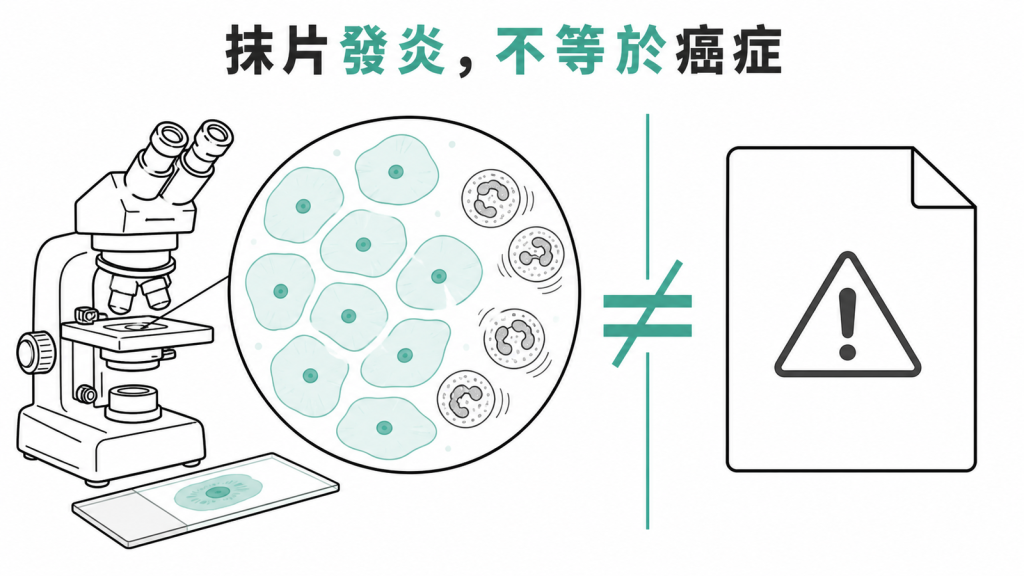抹片發炎不等於癌症