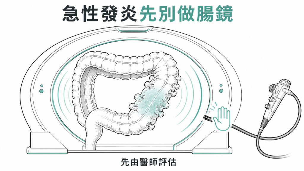 大腸憩室急性發炎期應先由醫師評估影像檢查而非做大腸鏡的衛教圖