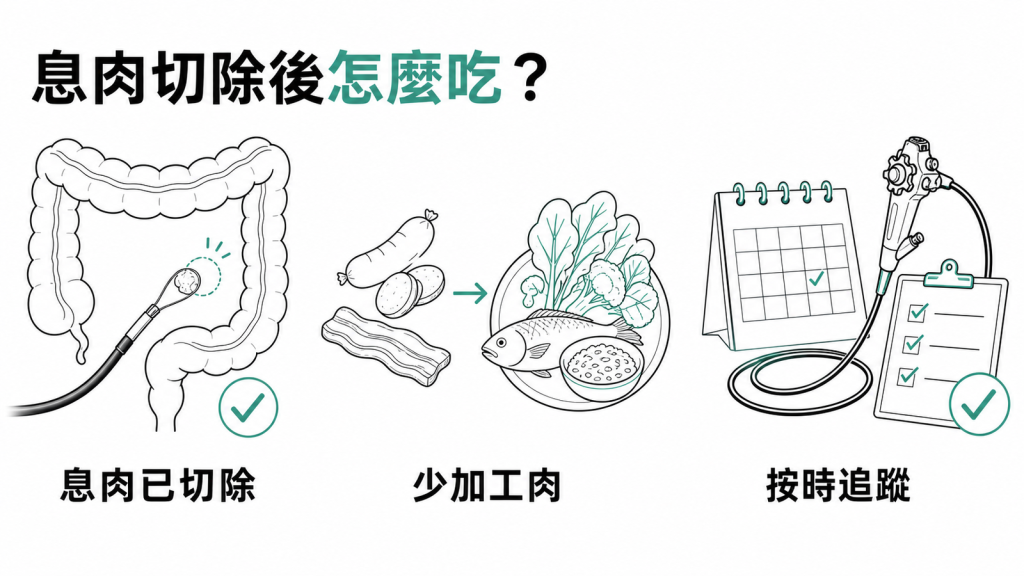 大腸息肉切除後怎麼吃:息肉已切除、少吃加工肉、按時追蹤大腸鏡的資訊圖