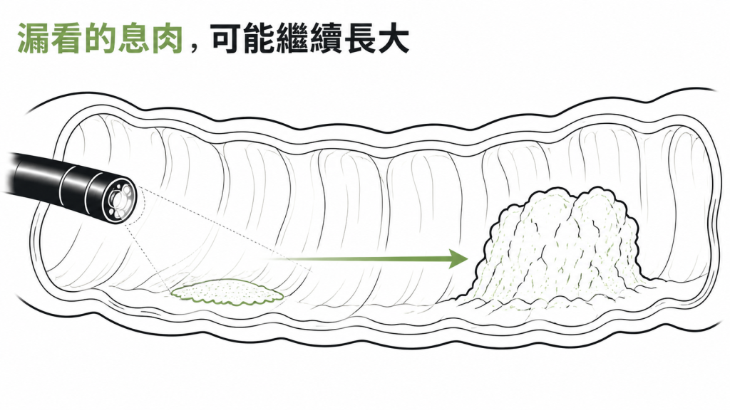 大腸鏡漏看的扁平息肉留在原地,之後可能慢慢長大成明顯的病灶