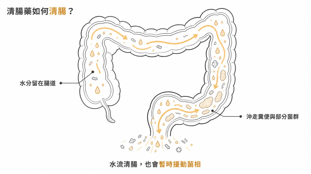 清腸藥把大量水分留在腸道、沖走糞便與部分菌群的示意圖