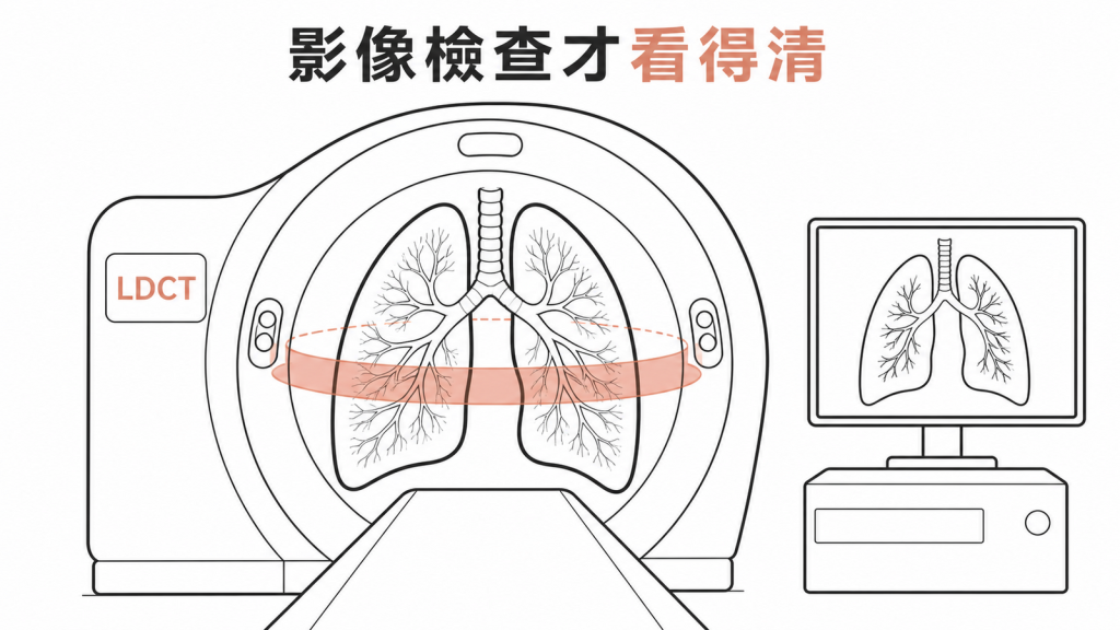 高風險者應與醫師討論低劑量電腦斷層檢查