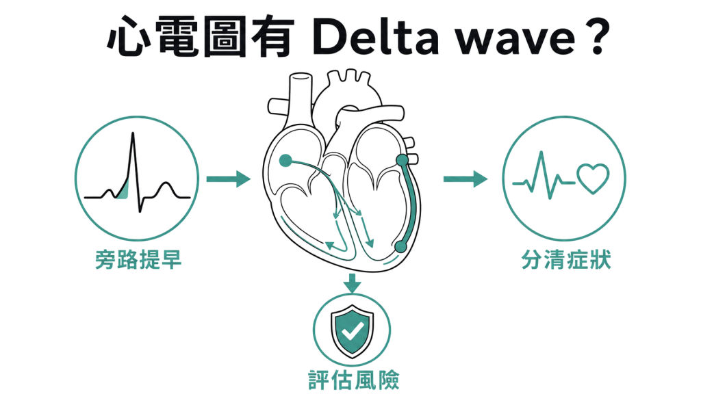 心室預激 Delta wave、旁路與風險評估圖解