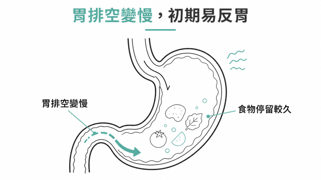 藥物讓胃排空變慢、食物停留較久,初期容易反胃