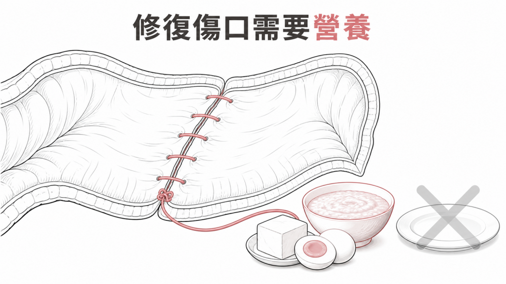 大腸息肉切除後完全禁食可能缺乏傷口修復所需營養的衛教圖