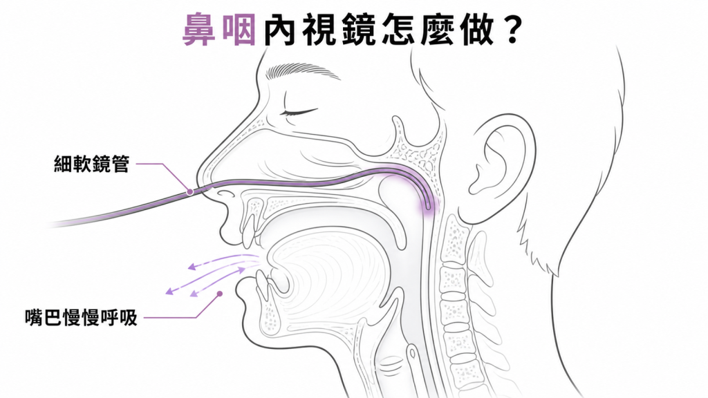 鼻咽內視鏡的檢查路徑與呼吸配合