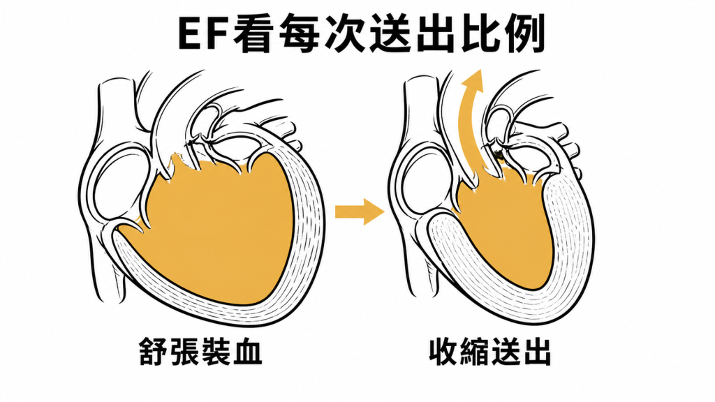 左心室射出分率EF比較舒張裝血與收縮送出比例示意圖