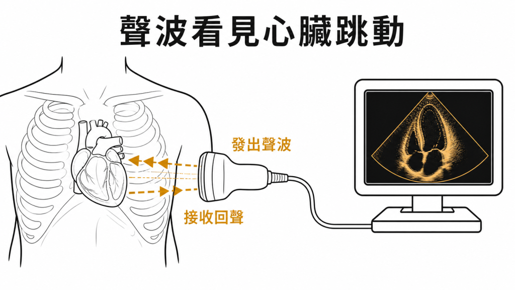 心臟超音波探頭發出聲波並接收心臟回聲形成影像示意圖