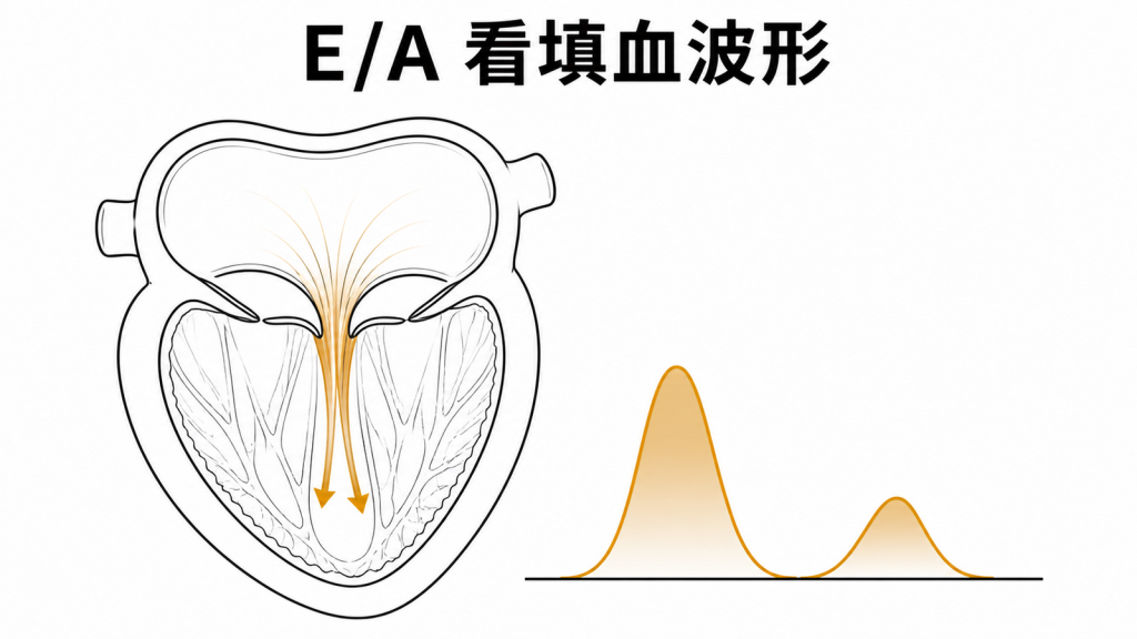 二尖瓣早期與晚期填血 E 波 A 波示意圖