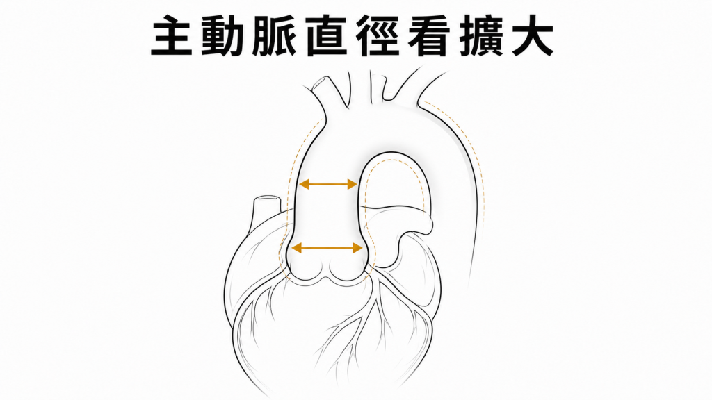 主動脈根部與升主動脈直徑量測示意圖