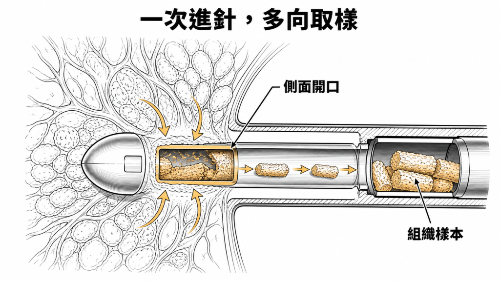 EnCor真空輔助乳房切片以側面開口多方向取得組織示意圖