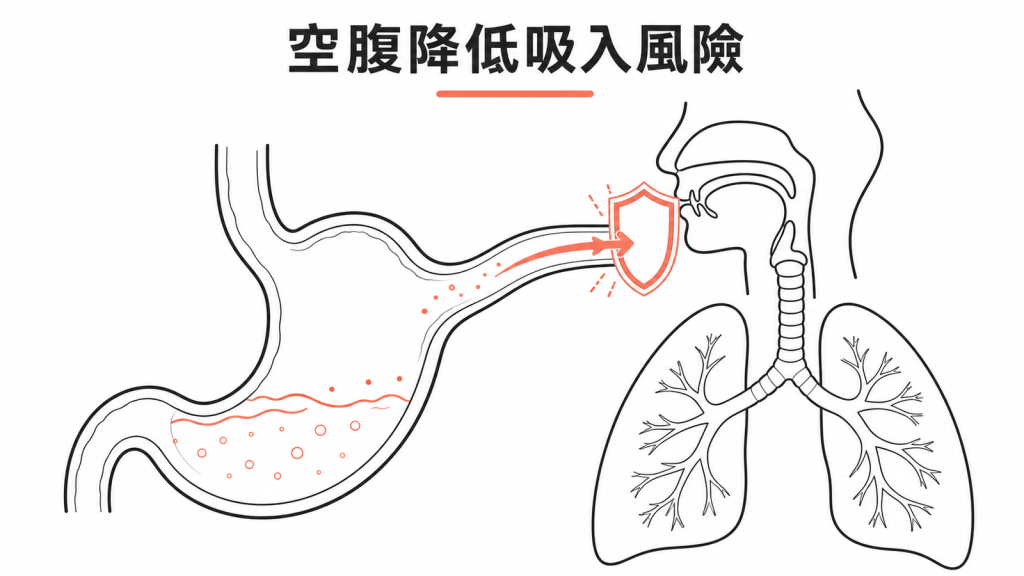 空腹降低胃內容物進入呼吸道的風險示意圖