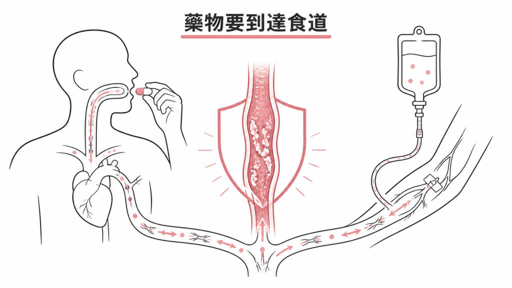 全身性抗黴菌藥經口服或靜脈到達食道示意圖