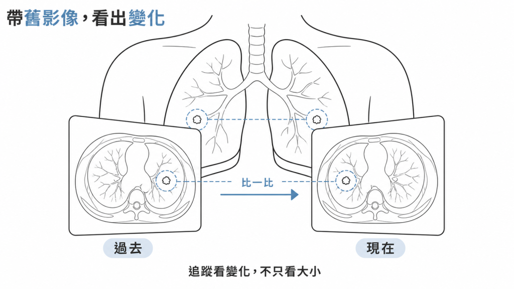 把過去的胸部電腦斷層帶來比對，追蹤看的是變化而不只是現在的大小